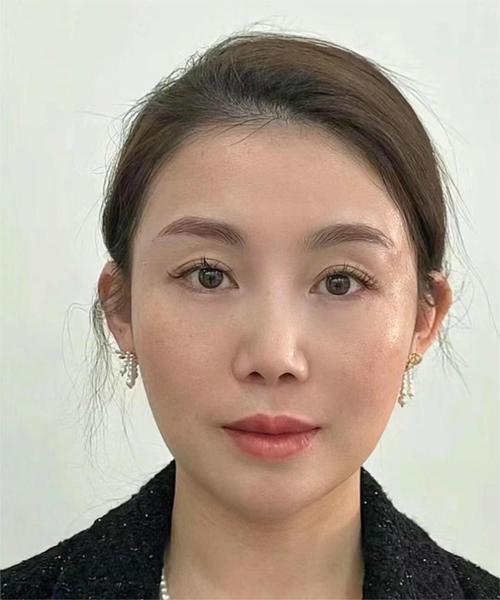 迅雷急先锋 迅雷急先锋电视剧全集免费观看